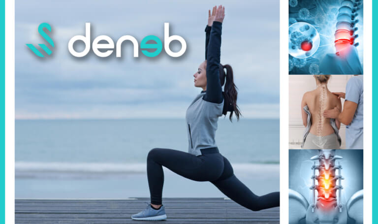 deneb medical