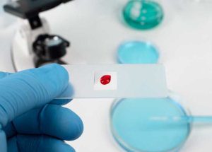 Erysafety: cómo prevenir los efectos adversos de los fármacos